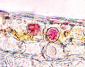Calanthe sieboldii キエビネ 唇弁基部着色部の細胞