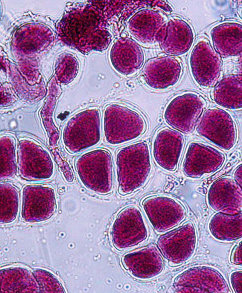 Calanthe discolor : Pollen tetrad and Pollen tube エビネの花粉四分子と発芽伸長中の花粉管