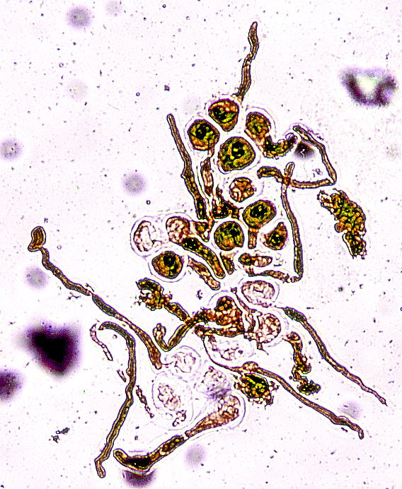 Calanthe discolor : Pollen tetrad and Pollen tube エビネの花粉四分子と発芽伸長中の花粉管